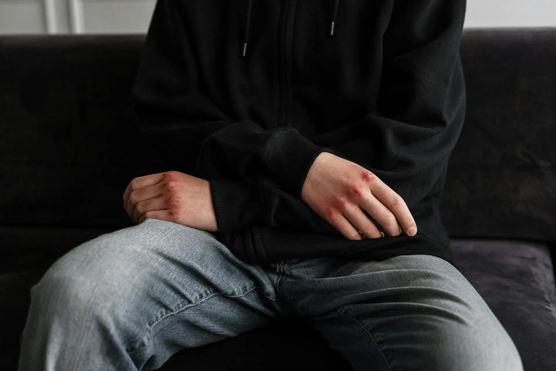 A close-up of a teenager with bruised hands, wearing a hoodie and jeans, sitting on a couch.